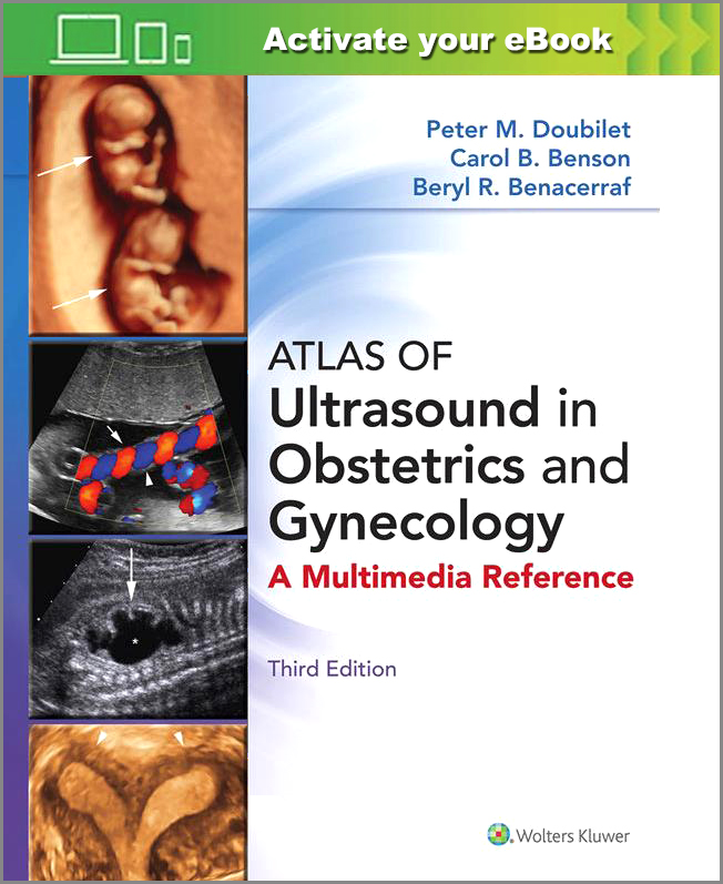 Atlas of Ultrasound in Obstetrics and Gynecology-3판 