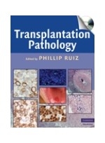 Transplantation Pathology