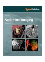 Abdominal Imaging(2vol)