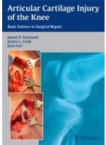 Articular Cartilage Injury of the Knee: Basic Science to Surgical Repair  