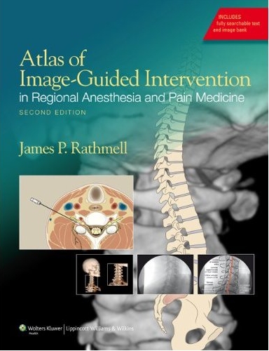 Atlas of Image-Guided Intervention in Regional Anesthesia and Pain Medicine, 2/e 