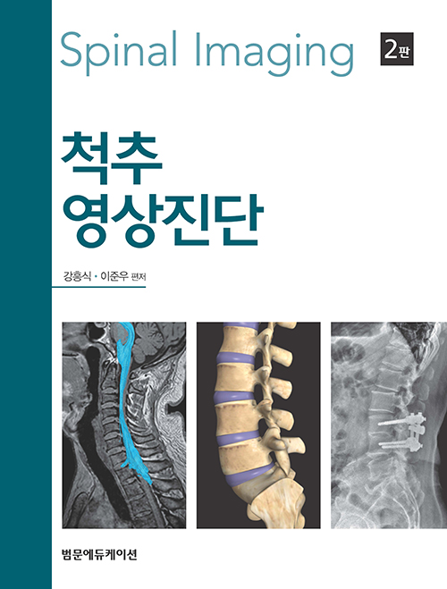 척추영상진단 Spinal Imaging - 제2판