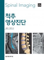 척추영상진단 Spinal Imaging - 제2판