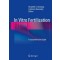 In Vitro Fertilization : A Comprehensive Guide 