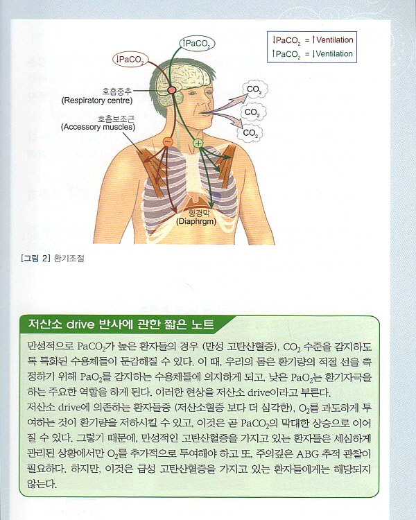 알기쉬운 동맥혈 가스분석