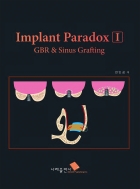 Implant Paradox I GBR & Sinus Grafting