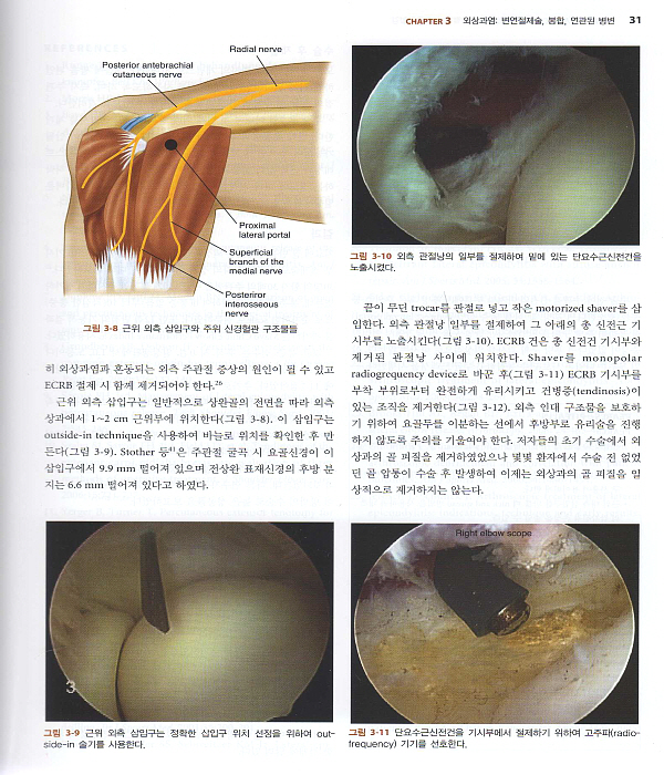 주관절경과 수근관절경(AANA Advanced Arthroscopy:The Elbow and Wrist)  DVD