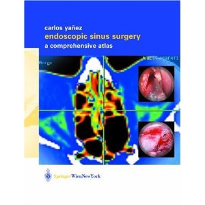 Endoscopic Sinus Surgery [Hardcover] 