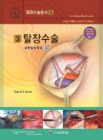 탈장수술 (외과수술총서3) Hernia