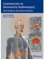 Controversies in Stereotactic Radiosurgery