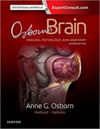 Osborns Brain,2/e-Imaging, Pathology & Anatomy 
