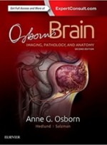 Osborns Brain,2/e-Imaging, Pathology & Anatomy 