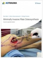 Minimally Invasive Plate Osteosynthesis (MIPO), 2/e