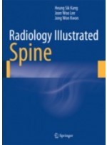 Radiology Illustrated:Spine