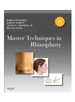 Master Techniques in Rhinoplasty with DVD