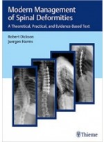 Modern Management of Spinal Deformities:A Theoretical, Practical, and Evidence-based Text