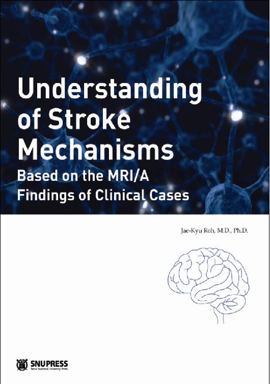 Understanding of Stroke Mechanisms-Based on the MRI/A Findings of Clinical Cases(뇌졸중기전)