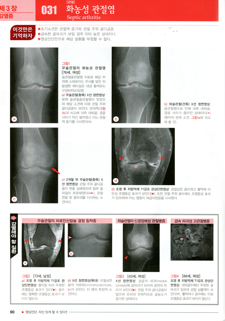 근골격계 영상진단 - 이것이 감별포인트 Differential diagnosis in Bone & Soft tissue