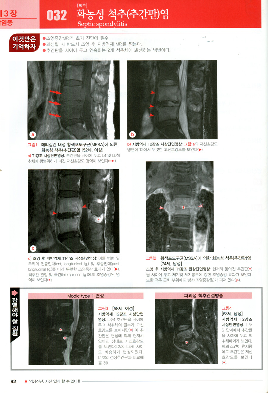 근골격계 영상진단 - 이것이 감별포인트 Differential diagnosis in Bone & Soft tissue