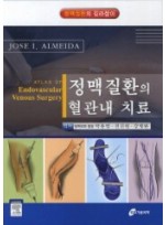 정맥질환의 혈관내 치료- 정맥질환의 길라잡이