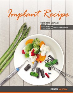 임플란트 레시피 (Implant Recipe)