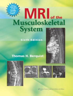 MRI of the Musculoskeletal System, 6/e