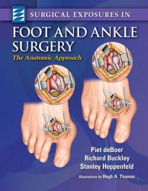 Surgical Exposures in Foot & Ankle Surgery