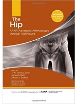 The Hip: AANA Advanced Arthroscopic Surgical Techniques 1 Har/Psc Edition 