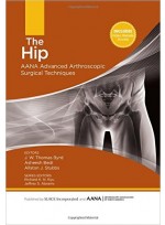 The Hip: AANA Advanced Arthroscopic Surgical Techniques 1 Har/Psc Edition 