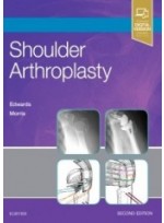 Shoulder Arthroplasty, 2/e