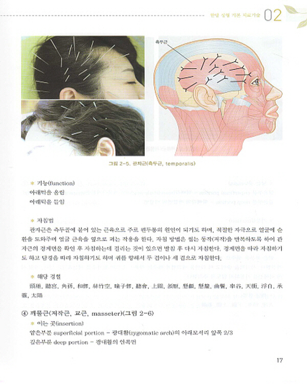 성형 침구학 (Cosmetic Acupuncture)