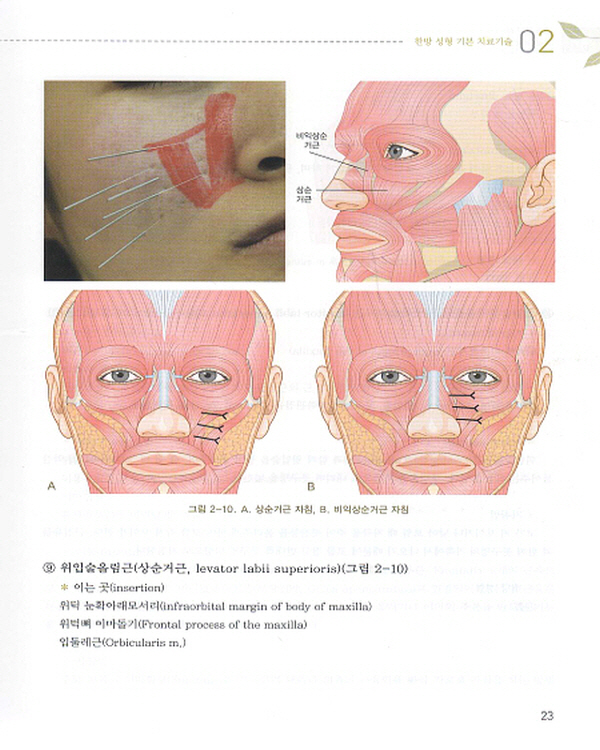 성형 침구학 (Cosmetic Acupuncture)