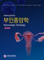 부인종양학 2판