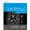 Duke Review of MRI Principles: Case Review Series