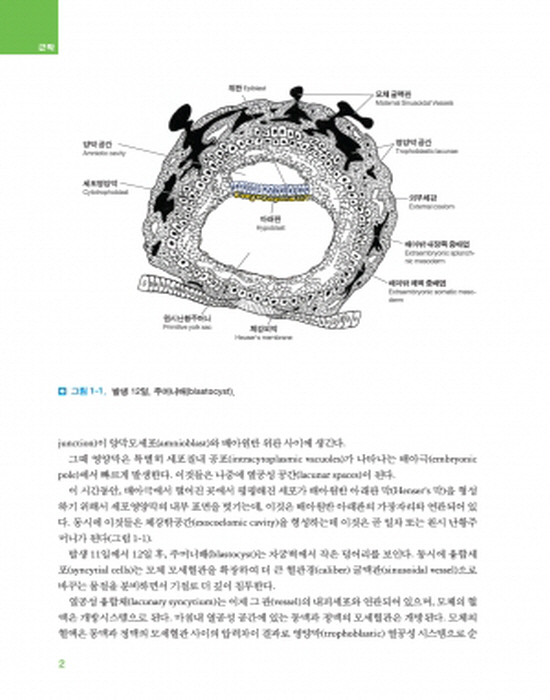 근막치료