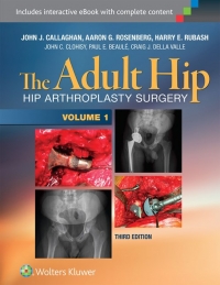 The Adult Hip (Two Volume Set) 3th