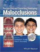 Recognizing and Correcting Developing Malocclusions: A Problem-Oriented Approach to Orthodontics  