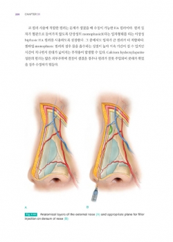 보툴리눔 필러 임상해부학 [우수학술도서] 