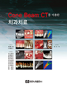 Cone Beam CT를 이용한 치과치료 