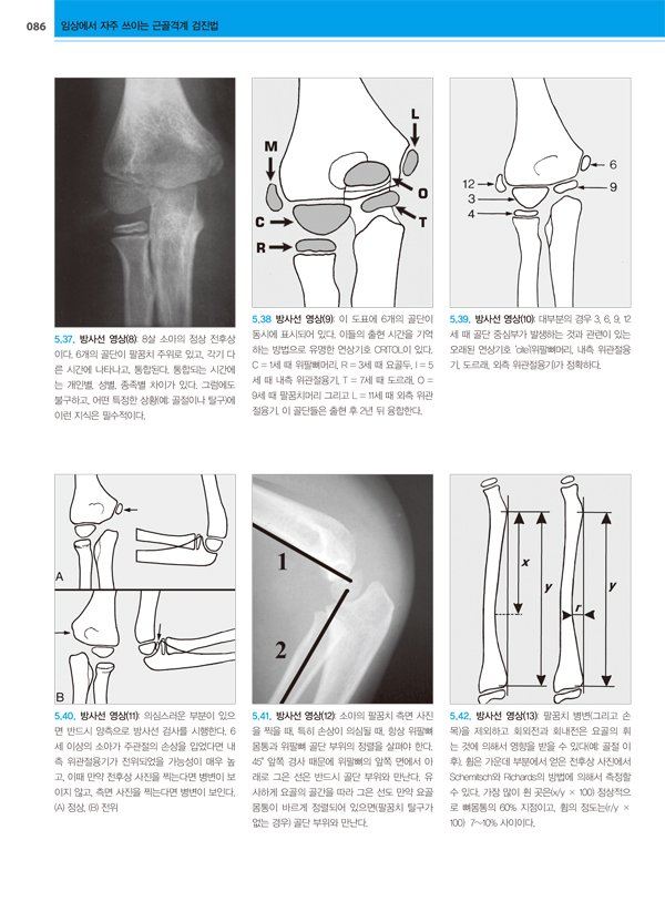 근골격계 검진법 - 임상에서 자주 쓰이는 (Clinical Orthopaedic Examination, 6/e)