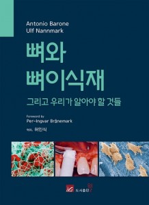 뼈와 뼈이식재 그리고 우리가 알아야 할 것들