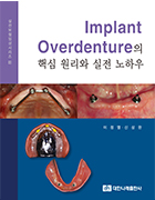 (실전보철임상시리즈 II) Implant Overdenture의 핵심 원리와 실전 노하우     