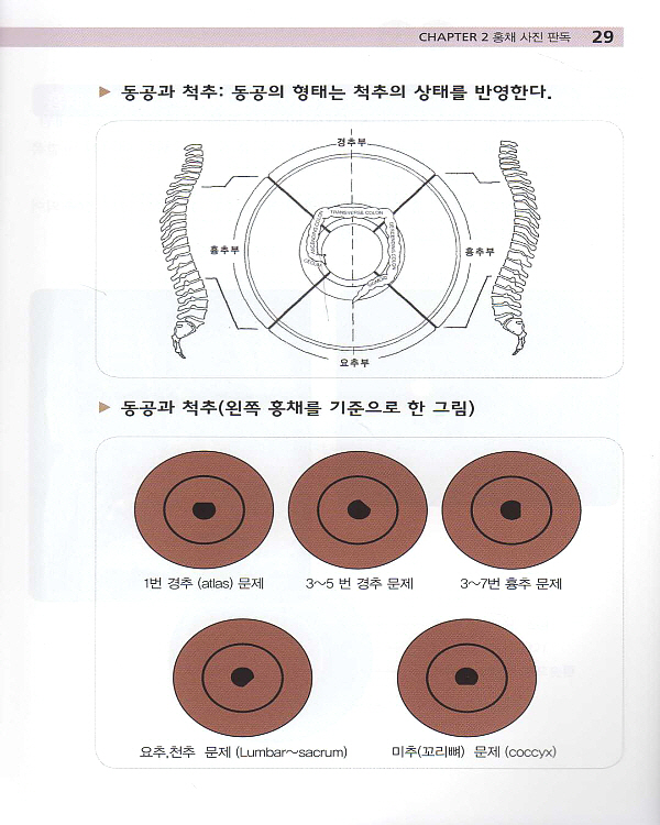 쉽게 배우는 임상 홍채학 