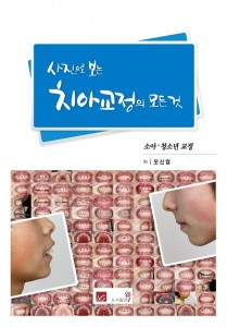 사진으로 보는 치아교정의 모든 것 - 소아청소년 교정