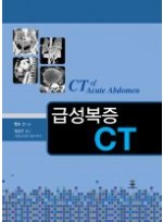 급성복증 CT (CT of Acute Abdomen)