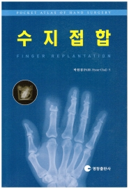 수지접합 - FINGER REPLANTATION