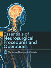 Essentials of Neurosurgical Procedures and Operations