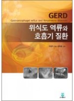 위식도 역류와 호흡기 질환(GERD)