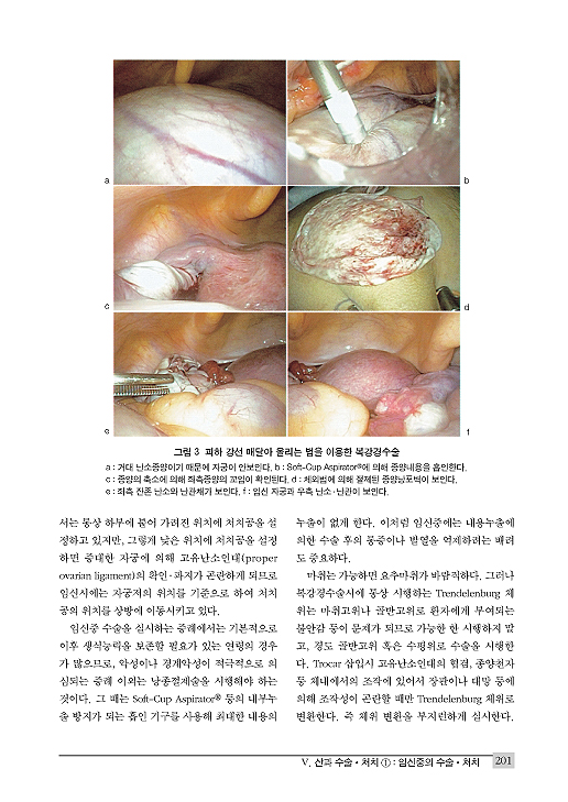 산부인과 수술 처치와 트러블 대처법 - 아무도 가르쳐 주지 않는