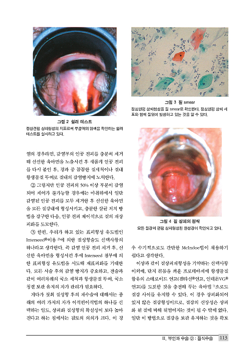 산부인과 수술 처치와 트러블 대처법 - 아무도 가르쳐 주지 않는